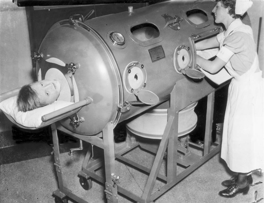 polio-patient-iron-lung.jpeg